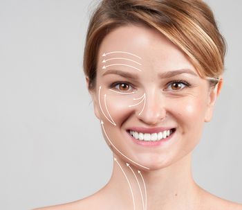 ¿Qué son los fillers faciales?