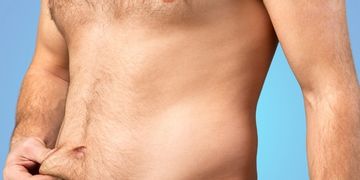 Celulitis masculina: ¿cómo acabar con ella?