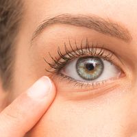 ¿Cómo se puede eliminar las bolsas en los ojos y las ojeras?