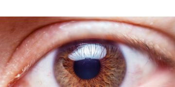 ¿Qué es un xantelasma?