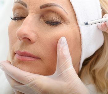 Lifting de la frente con botox