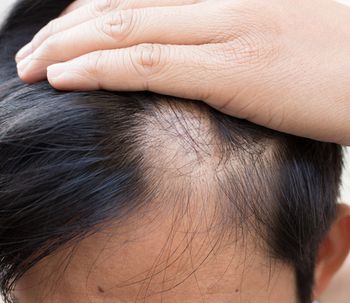 Cirugías y estética para Hombres - Ellos también se cuidan
