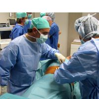 El lipoláser según el Dr. Esquide