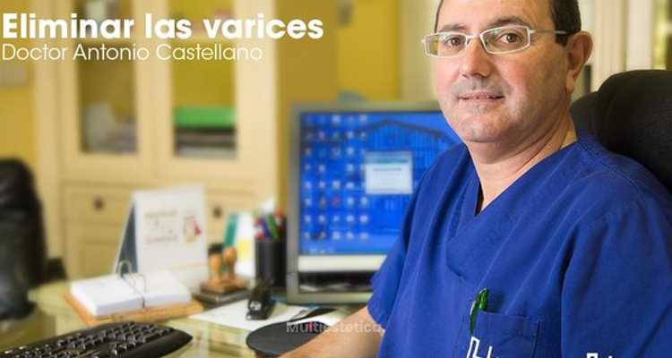 Eliminación de varices sin cirugía