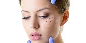 Ultherapy, un tratamiento premiado y reconocido