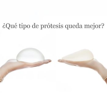 ¿Qué prótesis de mama queda mejor?