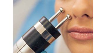 Radiofrecuencia en Medicina Estética