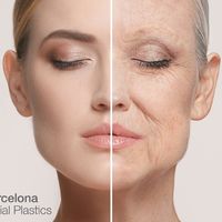 Lifting Facial y de Cuello. Rejuvenecimiento facial. Mejorar el aspecto de tu cara y cuello.