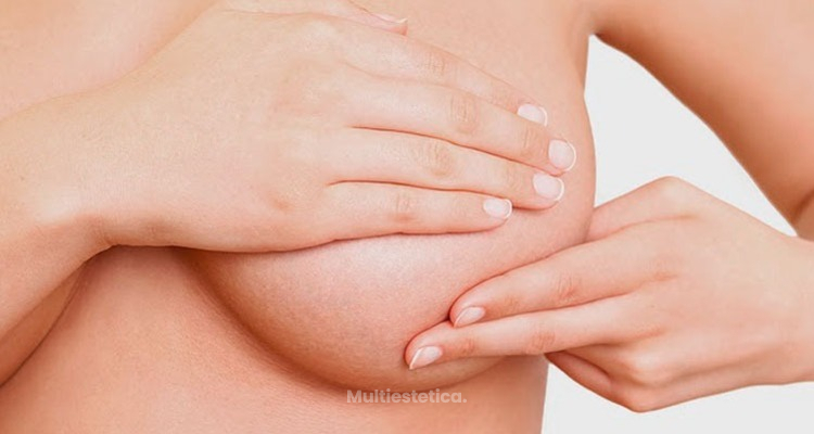 Cicatrices tras aumento de pecho: cómo cuidarlas