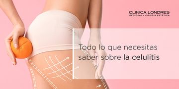 Todo lo que necesitas saber sobre la celulitis Todo lo que necesitas saber sobre la celulitis