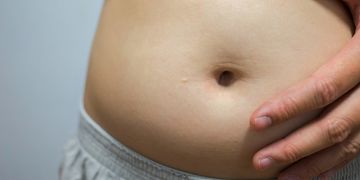 Las diferencias entre Método Pose y Balón Intragástrico Las diferencias entre Método Pose y Balón Intragástrico