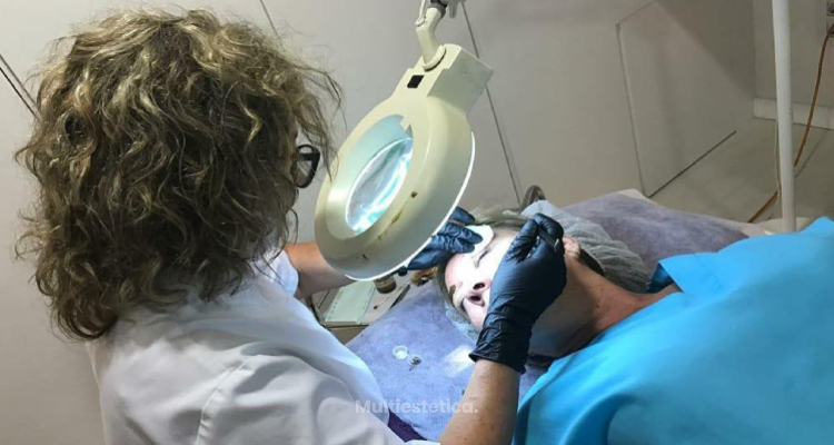 Todo lo que debes saber sobre la micropigmentación labial