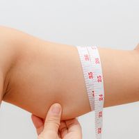 Presume de bíceps con la dermolipectomía y despídete de esconder los brazos bajo la ropa este verano