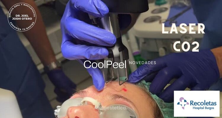 ¿Conoces el tratamiento CoolPeel con el láser CO₂ ?