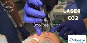 ¿Conoces el tratamiento CoolPeel con el láser CO₂ ? ¿Conoces el tratamiento CoolPeel con el láser CO₂ ?