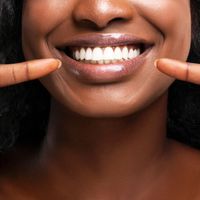 Los mejores tratamientos profesionales de blanqueamiento dental