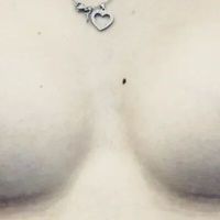 Errores comunes en aumento de mamas Errores comunes en aumento de mamas