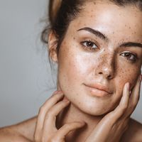 Descubre la carboxiterapia facial, la revolución del cuidado de la piel