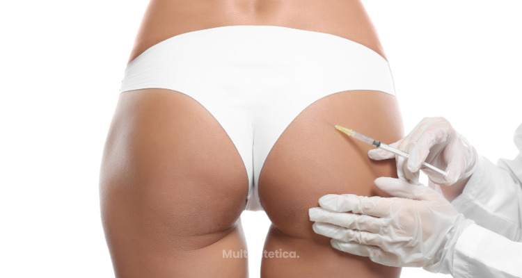 Recuperación natural del colágeno, efecto lifting y push up de glúteos