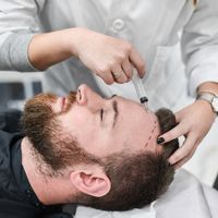Diferencias entre los microinjertos capilares y otras técnicas de trasplante de cabello