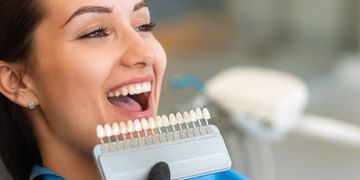 10 beneficios de las carillas dentales