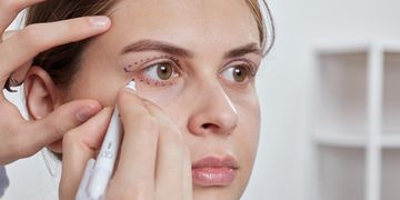 ¿Qué es la Blefaroplastia Completa?