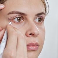 ¿Qué es la Blefaroplastia Completa?