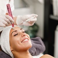 Microneedling facial: revitaliza tu piel