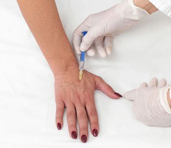 Todas las ventajas del bótox como producto estético (y médico)