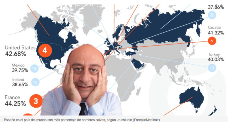 ¿Por qué España aparece entre los países con más calvicie y qué podemos hacer?