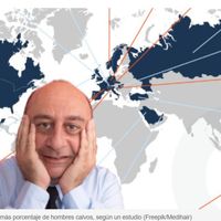 ¿Por qué España aparece entre los países con más calvicie y qué podemos hacer? ¿Por qué España aparece entre los países con más calvicie y qué podemos hacer?