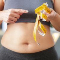 Todo lo que debes saber sobre POSE reducción de estómago