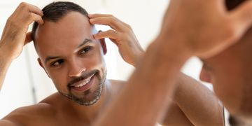 Microinjerto capilar personalizado: cuándo conviene hacerlo y qué resultados esperar Microinjerto capilar personalizado: cuándo conviene hacerlo y qué resultados esperar