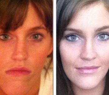 La cirugía estética le devuelve la sonrisa a los 25 años