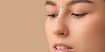 Rinoplastia: Todo lo que necesitas saber antes de transformar tu nariz