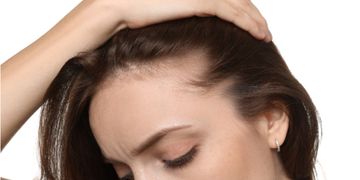 La salud capilar: cuándo prevenir, cuándo regenerar y cuándo plantear un injerto La salud capilar: cuándo prevenir, cuándo regenerar y cuándo plantear un injerto