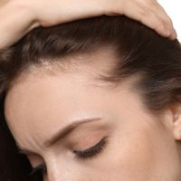 La salud capilar: cuándo prevenir, cuándo regenerar y cuándo plantear un injerto