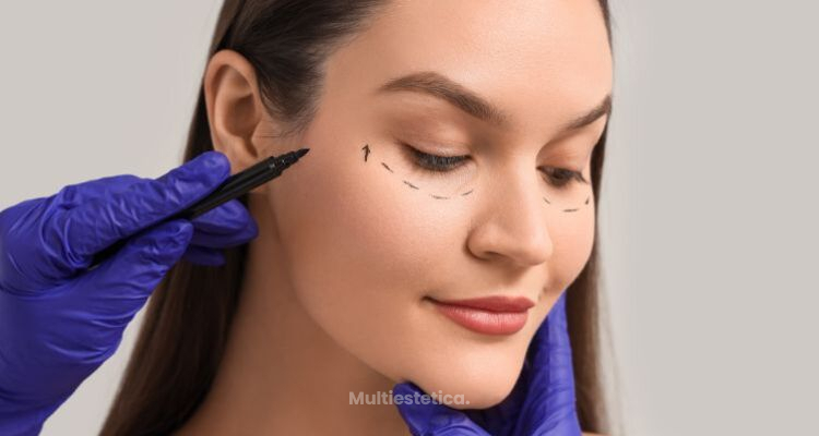 Blefaroplastia: las preguntas que más nos hacen en consulta