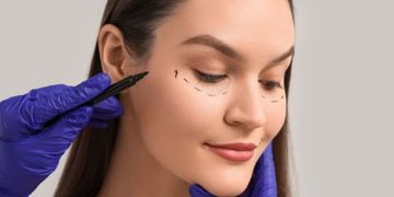 Blefaroplastia: las preguntas que más nos hacen en consulta Blefaroplastia: las preguntas que más nos hacen en consulta