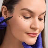 Blefaroplastia: las preguntas que más nos hacen en consulta