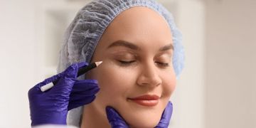 Dudas frecuentes sobre Blefaroplastia Dudas frecuentes sobre Blefaroplastia