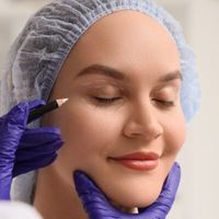 Dudas frecuentes sobre Blefaroplastia