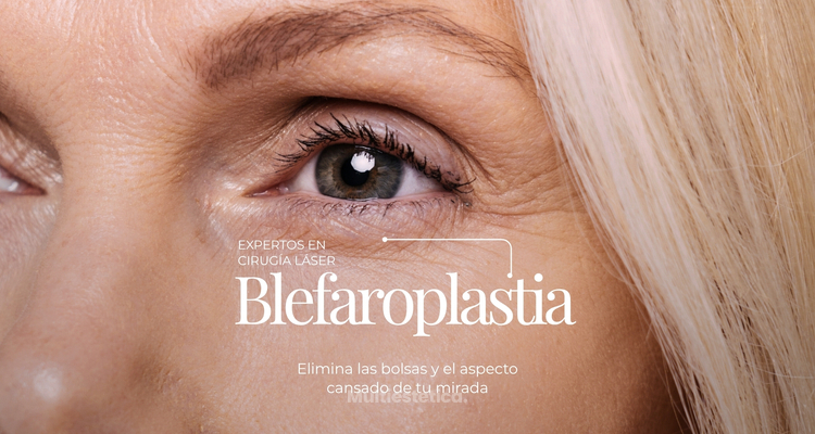 Blefaroplastia: ¿Cuánto tiempo necesitarás para volver a tu vida habitual?