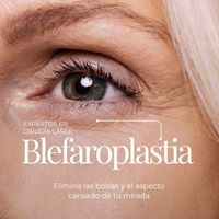 Blefaroplastia: ¿Cuánto tiempo necesitarás para volver a tu vida habitual?