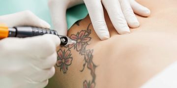 Skinial, la eliminación de tatuajes sin láser
