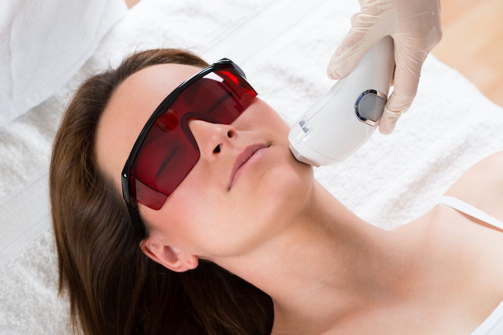 láser facial