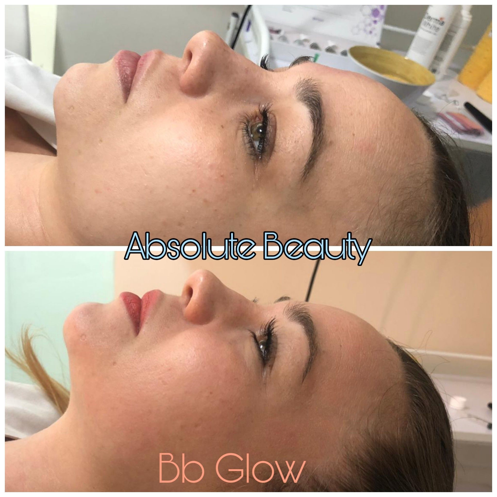 Resultados BB Glow