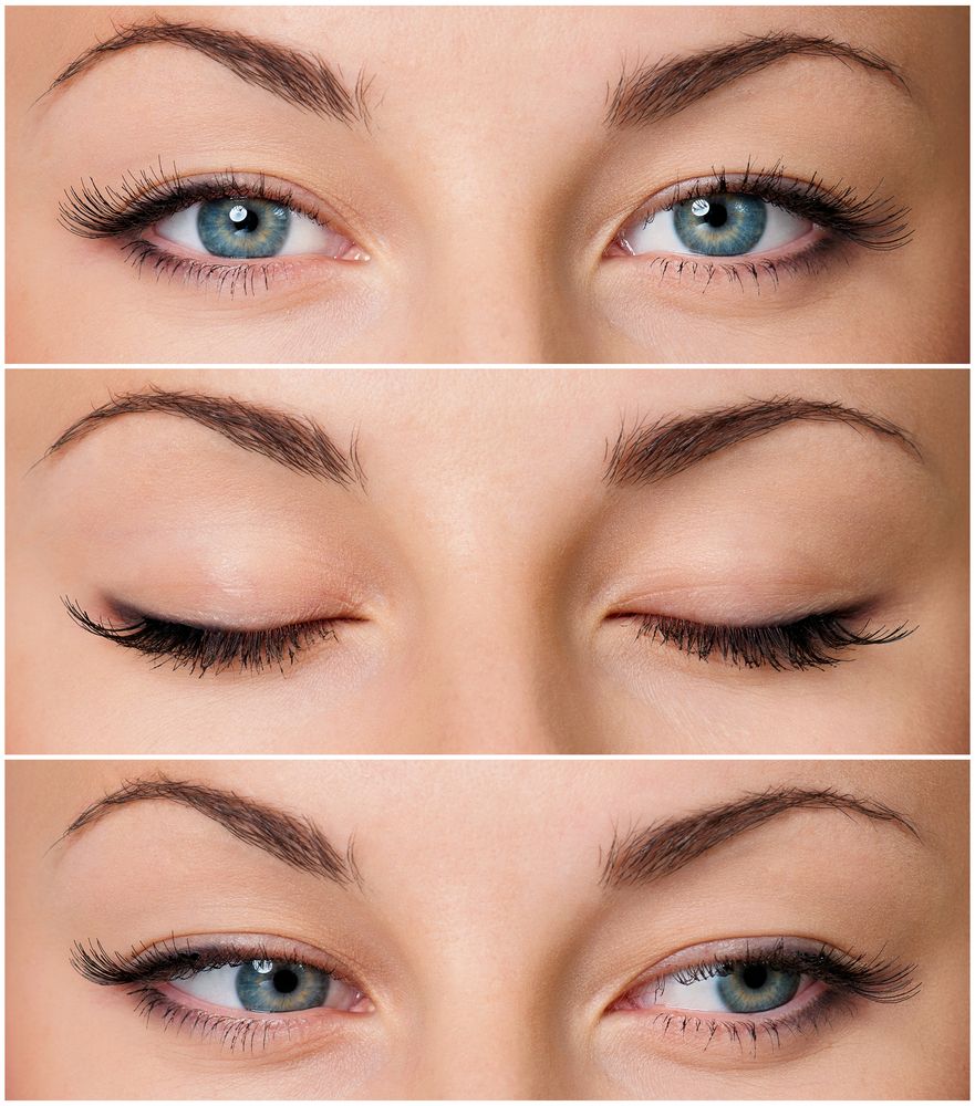 eliminación-de-ojeras-shutter.jpg