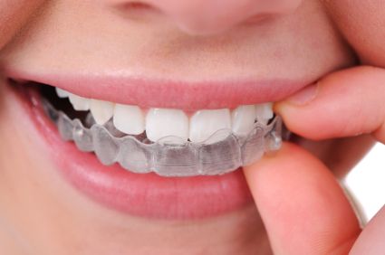 invisalign1.png