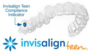 invisalign-teen.jpg